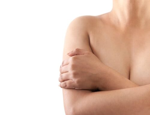 Breast reduction scars
